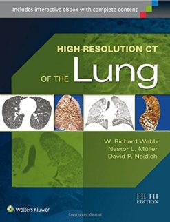High-Resolution CT of the Lung (EPUB)