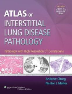 Atlas of Interstitial Lung Disease Pathology: Pathology with High Resolution CT Correlations (ORIGINAL PDF from Publisher)