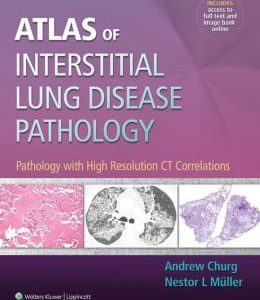 Atlas of Interstitial Lung Disease Pathology: Pathology with High Resolution CT Correlations (ORIGINAL PDF from Publisher)