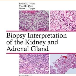 Biopsy Interpretation of the Kidney & Adrenal Gland (Biopsy Interpretation Series) (EPUB)