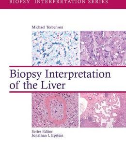 Biopsy Interpretation of the Liver (EPUB)
