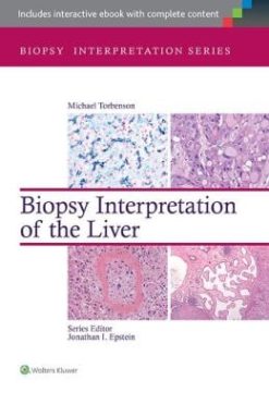 Biopsy Interpretation of the Liver (ORIGINAL PDF from Publisher)