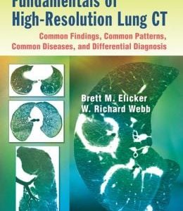 Fundamentals of High-Resolution Lung CT: Common Findings, Common Patterns, Common Diseases, and Differential Diagnosis (ORIGINAL PDF from Publisher)