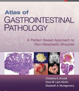 Atlas of Gastrointestinal Pathology: A Pattern Based Approach to Non-Neoplastic Biopsies (EPUB)
