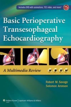 Basic Perioperative Transesophageal Echocardiography (ORIGINAL PDF from Publisher)