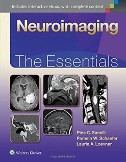 Neuroimaging: The Essentials (Essentials series) (EPUB)