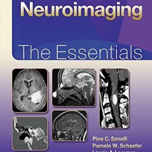 Neuroimaging: The Essentials (Essentials series) (EPUB)