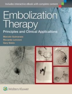 Embolization Therapy: Principles and Clinical Applications (EPUB)