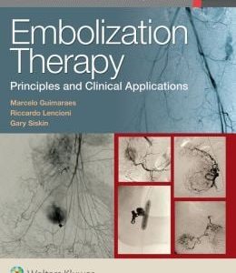 Embolization Therapy: Principles and Clinical Applications (EPUB)