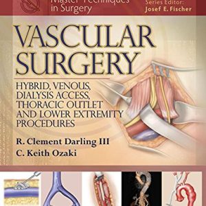 Master Techniques in Surgery: Vascular Surgery: Hybrid, Venous, Dialysis Access, Thoracic Outlet, and Lower Extremity Procedures (EPUB)