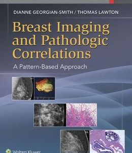 Breast Imaging and Pathologic Correlations: A Pattern-Based Approach (EPUB)