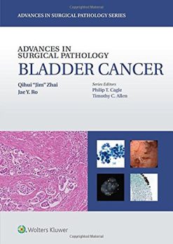 Advances in Surgical Pathology: Bladder Cancer (EPUB)