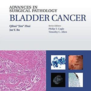 Advances in Surgical Pathology: Bladder Cancer (EPUB)
