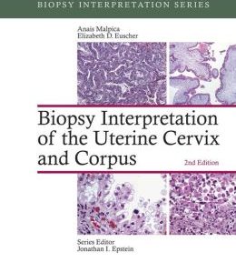 Biopsy Interpretation of the Uterine Cervix and Corpus (EPUB)