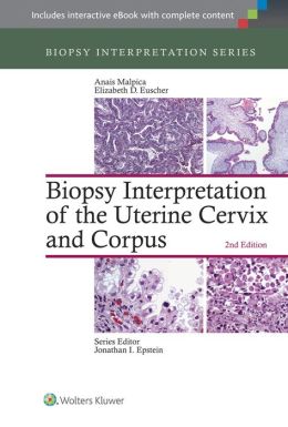 Biopsy Interpretation of the Uterine Cervix and Corpus (EPUB)