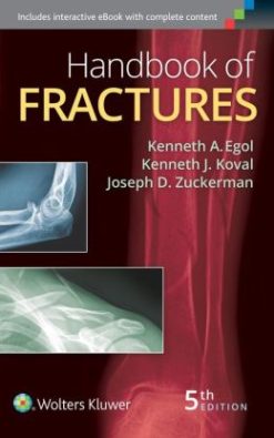 Handbook of Fractures, 5th Edition (EPUB)