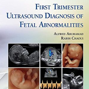 First Trimester Ultrasound Diagnosis of Fetal Abnormalities (EPUB)