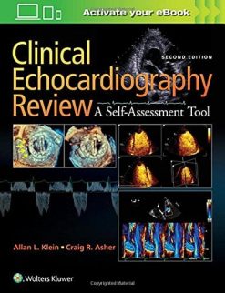 Clinical Echocardiography Review, 2nd Edition (EPUB)