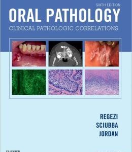 Oral Pathology: Clinical Pathologic Correlations, 6th Edition