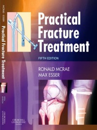 Practical Fracture Treatment, 5e (Original PDF from Publisher)