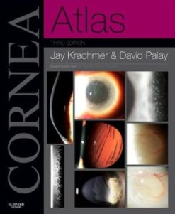 Cornea Atlas, 3rd Edition (PDF)