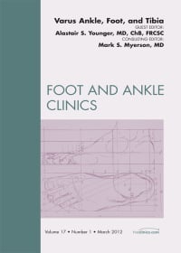 Varus Foot, Ankle, and Tibia, An Issue of Foot and Ankle Clinics, 1th edition (The Clinics: Orthopedics)