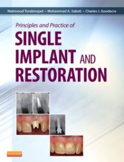 Principles and Practice of Single Implant and Restorations