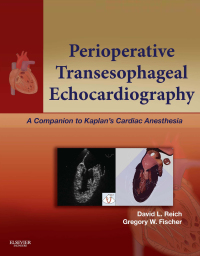 Perioperative Transesophageal Echocardiography: A Companion to Kaplan’s Cardiac Anesthesia (Original PDF from Publisher)