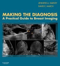 Making the Diagnosis: A Practical Guide to Breast Imaging (Original PDF from Publisher)