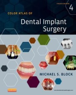 Color Atlas of Dental Implant Surgery, 4th Edition (ORIGINAL PDF from Publisher)