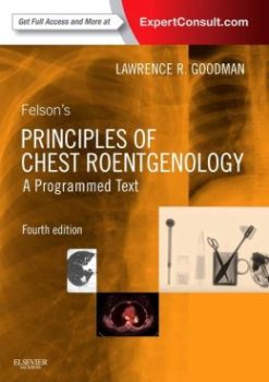 Felson’s Principles of Chest Roentgenology, A Programmed Text, 4th Edition (ORIGINAL PDF from Publisher)