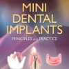 Mini Dental Implants: Principles and Practice (Original PDF from Publisher)