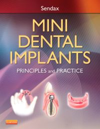 Mini Dental Implants: Principles and Practice (Original PDF from Publisher)