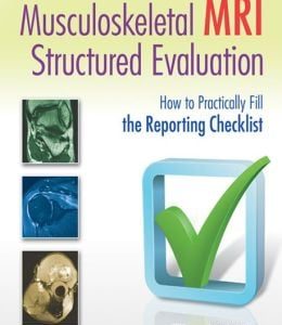 Musculoskeletal MRI Structured Evaluation: How to Practically Fill the Reporting Checklist (EPUB)