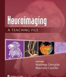 Neuroimaging: A Teaching File (EPUB)