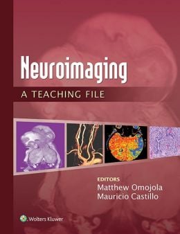 Neuroimaging: A Teaching File (EPUB)