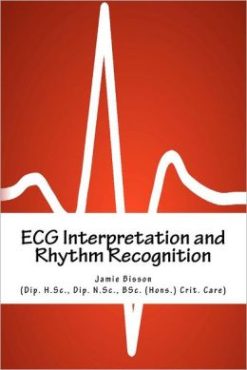 ECG Interpretation and Rhythm Recognition (EPUB)