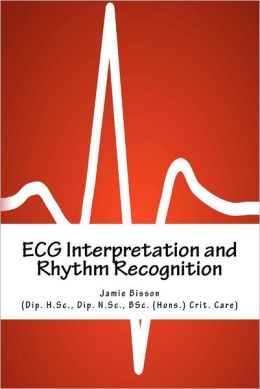 ECG Interpretation and Rhythm Recognition (EPUB)
