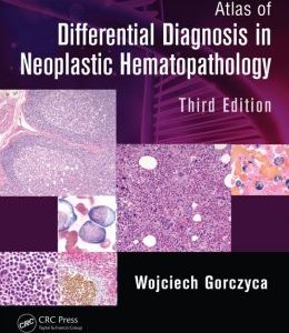 Atlas of Differential Diagnosis in Neoplastic Hematopathology, Third Edition