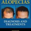 The Alopecias: Diagnosis and Treatments (Original PDF from Publisher)