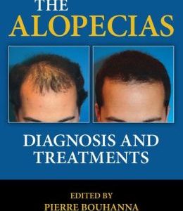 The Alopecias: Diagnosis and Treatments (Original PDF from Publisher)