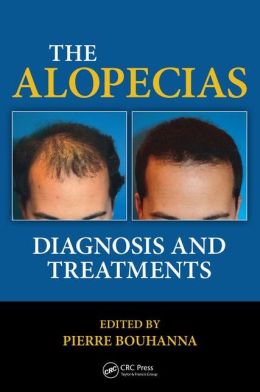 The Alopecias: Diagnosis and Treatments (Original PDF from Publisher)