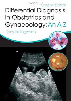 Differential Diagnosis in Obstetrics & Gynaecology: An A-Z, Second Edition (Original PDF from Publisher)