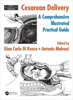Cesarean Delivery: A Comprehensive Illustrated Practical Guide (3D Photorealistic Rendering) (PDF)