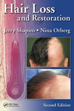 Hair Loss and Restoration, 2nd Edition