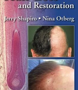 Hair Loss and Restoration, 2nd Edition