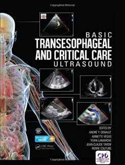 Basic Transesophageal and Critical Care Ultrasound (Original PDF from Publisher)