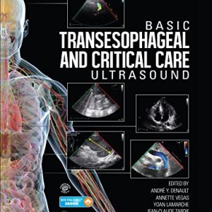 Basic Transesophageal and Critical Care Ultrasound (Original PDF from Publisher)