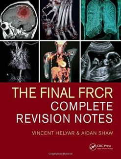 The Final FRCR: Complete Revision Notes (Original PDF from Publisher)