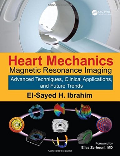 Heart Mechanics: Magnetic Resonance Imaging―Advanced Techniques, Clinical Applications, and Future Trends (Volume 2) (PDF)